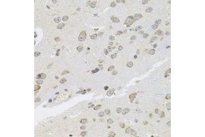 Immunohistochemistry of paraffin-embedded mouse brain using VEPH1 antibody (ABIN5974616) (40x lens). (VEPH1 antibody)