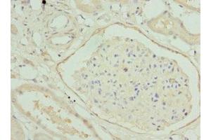 Immunohistochemistry of paraffin-embedded human kidney tissue using ABIN7155892 at dilution of 1:100 (HGD antibody  (AA 226-445))