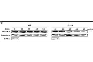 Western Blotting (WB) image for anti-Muscle, Skeletal, Receptor Tyrosine Kinase (MUSK) (AA 35-65), (N-Term) antibody (ABIN392019)