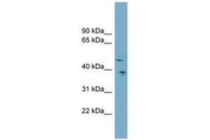 Image no. 1 for anti-Sparc/osteonectin, Cwcv and Kazal-Like Domains Proteoglycan (Testican) 3 (SPOCK3) (AA 359-408) antibody (ABIN6743341) (SPOCK3 antibody  (AA 359-408))