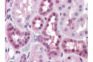 Immunohistochemical analysis of paraffin-embedded human Liver tissues using anti-BHMT antibody (ERK1/2 antibody)