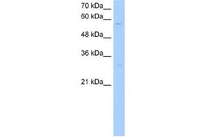WB Suggested Anti-STEAP4 Antibody Titration:  0.