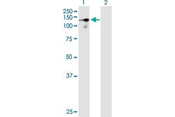 CHERP antibody  (AA 1-884)