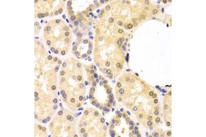 Immunohistochemistry of paraffin-embedded human kidney using SMAD1 antibody.