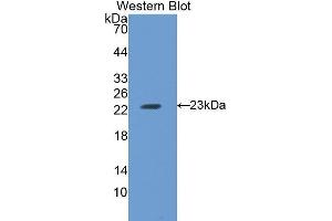 Western Blotting (WB) image for anti-Ferritin, Heavy Polypeptide 1 (FTH1) (AA 1-182) antibody (ABIN1078027)