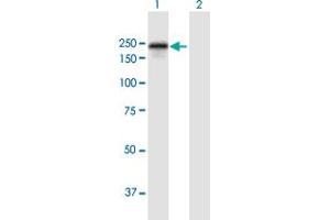 Western Blot analysis of DLC1 expression in transfected 293T cell line by DLC1 MaxPab polyclonal antibody. (DLC1 antibody  (AA 1-1528))