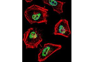 Fluorescent confocal image of Hela cell stained with (MOUSE) Ncor1 Antibody. (NCOR1 antibody  (N-Term))