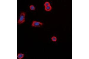 Immunofluorescent analysis of MC5 Receptor staining in MCF7 cells. (MC5 Receptor antibody  (C-Term))