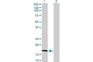 Western Blot analysis of FGF1 expression in transfected 293T cell line by FGF1 MaxPab polyclonal antibody. (FGF1 antibody  (AA 1-155))