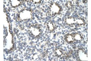 Rabbit Anti-JUN Antibody       Paraffin Embedded Tissue:  Human alveolar cell   Cellular Data:  Epithelial cells of renal tubule  Antibody Concentration:   4. (C-JUN antibody  (N-Term))