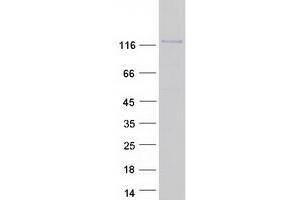 Validation with Western Blot (Contactin 1 Protein (CNTN1) (Transcript Variant 2) (Myc-DYKDDDDK Tag))