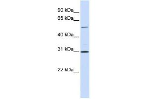 NEK3 antibody used at 1 ug/ml to detect target protein. (NEK3 antibody)