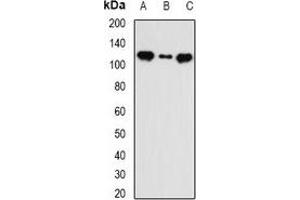 Western blot analysis of INTS5 expression in MCF7 (A), HT29 (B), mouse liver (C) whole cell lysates. (INTS5 antibody)