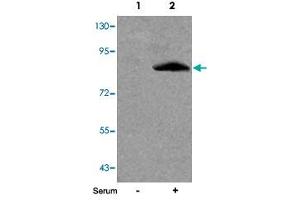 Western blot analysis of extracts from 293 cells untreated (Lane 1) or treated (Lane 2) with serum using FOXO1 (phospho S256) polyclonal antibody . (FOXO1 antibody  (pSer256))