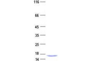 Validation with Western Blot (INTS6 Protein (His tag))