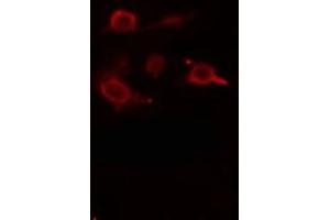ABIN6275499 staining  RAW264. (ARHGEF5 antibody  (Internal Region))