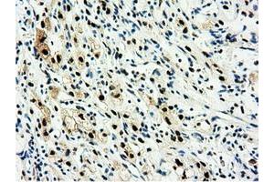 Image no. 7 for anti-5'-Nucleotidase Domain Containing 1 (NT5DC1) antibody (ABIN1499838)