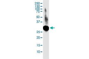 LACTB2 monoclonal antibody (M02), clone 1H3. (LACTB2 antibody  (AA 1-288))