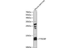 Western blot analysis of extracts of mouse pancreas, using TYROBP antibody (ABIN7271115) at 1:3000 dilution. (TYROBP antibody  (C-Term))