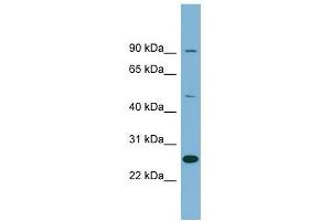 LRRC49 antibody used at 1 ug/ml to detect target protein. (LRRC49 antibody  (N-Term))
