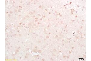 Formalin-fixed and paraffin embedded rat brain labeled with Rabbit Anti DRP1/DNM1L Polyclonal Antibody, Unconjugated  at 1:200 followed by conjugation to the secondary antibody and DAB staining (CSRP2 antibody  (AA 101-200))
