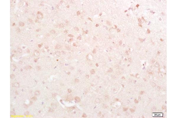 CSRP2 antibody  (AA 101-200)