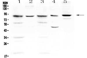 Western blot analysis of NADPH oxidase 4 using anti-NADPH oxidase 4 antibody .