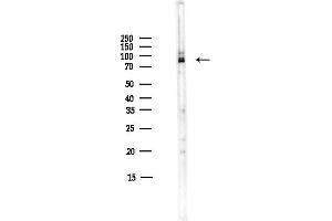anti-P-Cadherin (CDH3) (N-Term) antibody