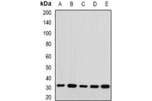 Western blot analysis of RPL14 expression in Jurkat (A), HepG2 (B), mouse spleen (C), mouse ovary (D), rat kidney (E) whole cell lysates. (RPL14 antibody)