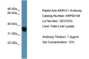 WB Suggested Anti-AKR1C1  Antibody Titration: 0. (AKR1C1 antibody  (N-Term))