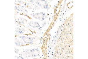 Immunohistochemistry of paraffin-embedded rat kidney using Caspase-7 Rabbit pAb (ABIN3022071, ABIN3022072, ABIN3022073 and ABIN6218596) at dilution of 1:150 (40x lens). (Caspase 7 antibody  (AA 24-303))