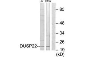 Western blot analysis of extracts from RAW264. (DUSP22 antibody  (AA 121-170))