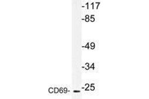 Western blot (WB) analysis of CD69 antibody in extracts from HUVEC cells. (CD69 antibody)