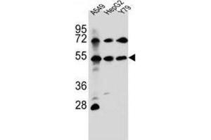 Western Blotting (WB) image for anti-Fibroblast Growth Factor Receptor-Like 1 (FGFRL1) antibody (ABIN2996911)