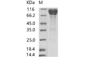 Western Blotting (WB) image for Sudan Ebola Virus Envelope Glycoprotein (SEBOV GP) protein (Fc Tag) (ABIN7198920) (SEBOV GP Protein (Fc Tag))