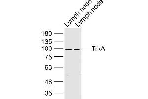 Lane 1: mouse lymph node lysates Lane 2: rat Lymph node lysates probed with TrkA Polyclonal Antibody, Unconjugated  at 1:300 dilution and 4˚C overnight incubation. (TRKA antibody  (AA 725-821))