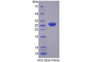 Image no. 1 for Cyclin-Dependent Kinase 16 (CDK16) (AA 165-446) protein (His tag) (ABIN4990241) (CDK16 Protein (AA 165-446) (His tag))