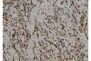 ABIN6272973 at 1/100 staining Human gastric tissue by IHC-P. (PBXIP1 antibody  (C-Term))