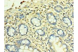 Immunohistochemistry of paraffin-embedded human small intestine tissue using ABIN7166178 at dilution of 1:100 (TFG antibody  (AA 1-240))