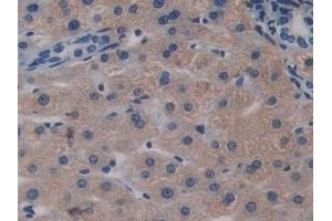 Detection of BGN in Human Liver Tissue using Polyclonal Antibody to Biglycan (BGN) (Biglycan antibody  (AA 230-366))