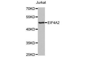 Western blot analysis of extracts of Jurkat cell lines, using EIF4A2 antibody. (EIF4A2 antibody  (AA 1-270))