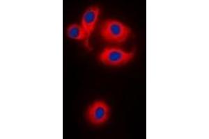Immunofluorescent analysis of MRPS22 staining in HEK293T cells. (MRPS22 antibody)