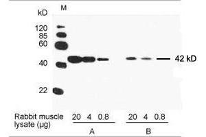 Primary antibody: A. (beta Actin antibody)