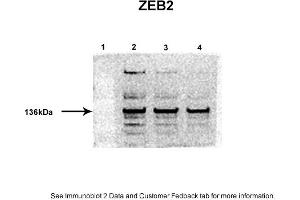 Sample Type: 1. (ZEB2 antibody  (Middle Region))