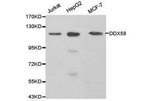 Western Blotting (WB) image for anti-DEAD (Asp-Glu-Ala-Asp) Box Polypeptide 58 (DDX58) antibody (ABIN1872240) (DDX58 antibody)