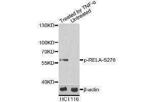 Western blot analysis of extracts of HCT116 cells, using Phospho-RELA-S276 antibody (ABIN6003884). (NF-kB p65 antibody  (pSer276))