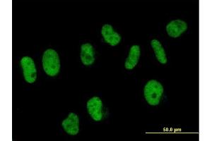 Immunofluorescence of purified MaxPab antibody to SART3 on HeLa cell. (SART3 antibody)