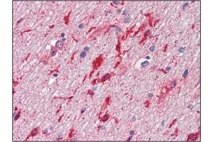 Immunohistochemistry (IHC) image for anti-Hepatocyte Growth Factor (Hepapoietin A, Scatter Factor) (HGF) antibody (ABIN492557) (HGF antibody)