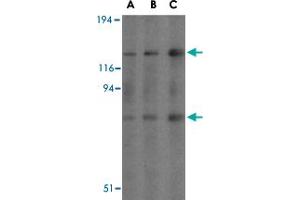 Western blot analysis of AGAP2 in mouse brain tissue lysates with AGAP2 polyclonal antibody  at (A) 0.