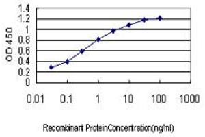 Detection limit for recombinant GST tagged BRD2 is approximately 0. (BRD2 antibody  (AA 167-256))
